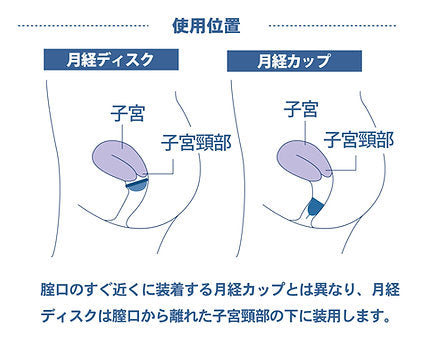【フルムーンガール】フルムーンディスク　レギュラー